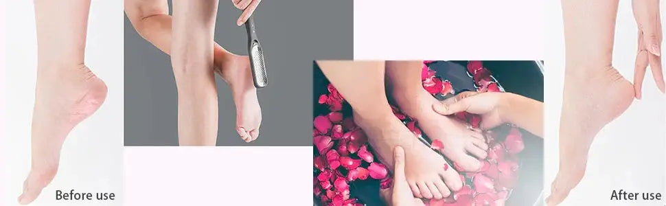 Professional Pedicure Tools Set,